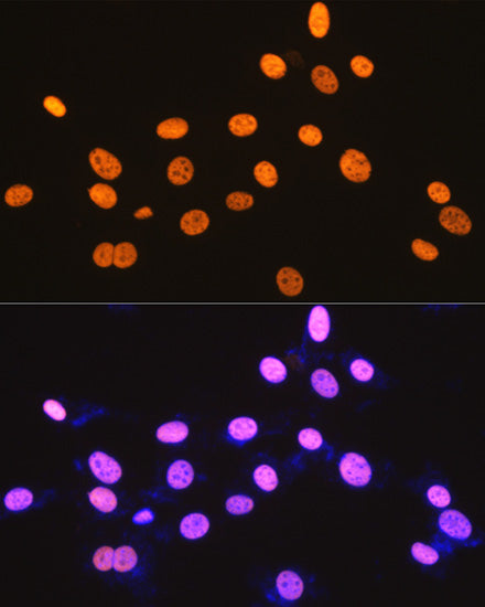 DDX5 Rabbit mAb