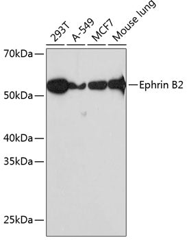 Ephrin B2 Rabbit mAb