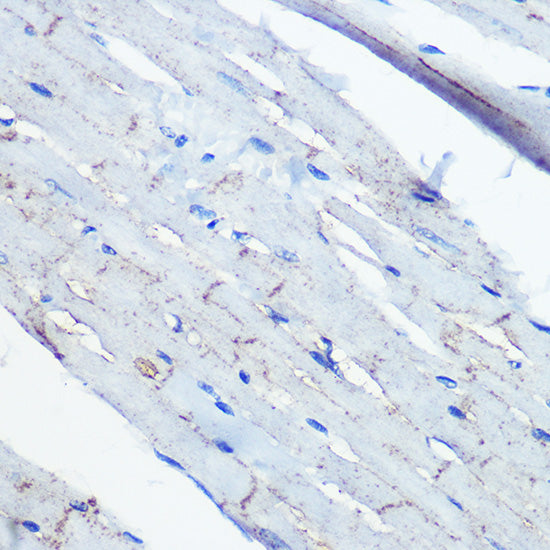 Ephrin B2 Rabbit mAb