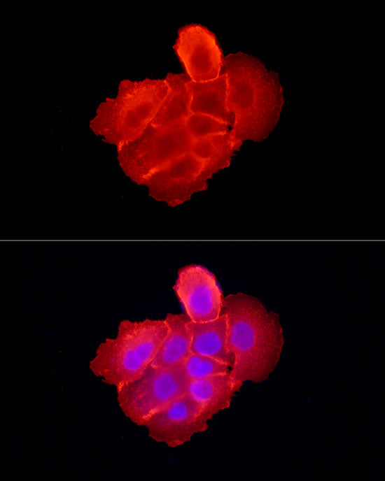 EGFR Rabbit pAb