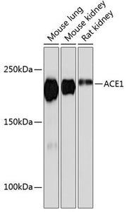 ACE1 Rabbit mAb