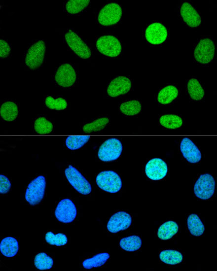 Histone H2AX Rabbit pAb