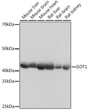 GOT1 Rabbit mAb