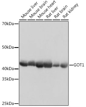 GOT1 Rabbit mAb