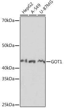 GOT1 Rabbit mAb