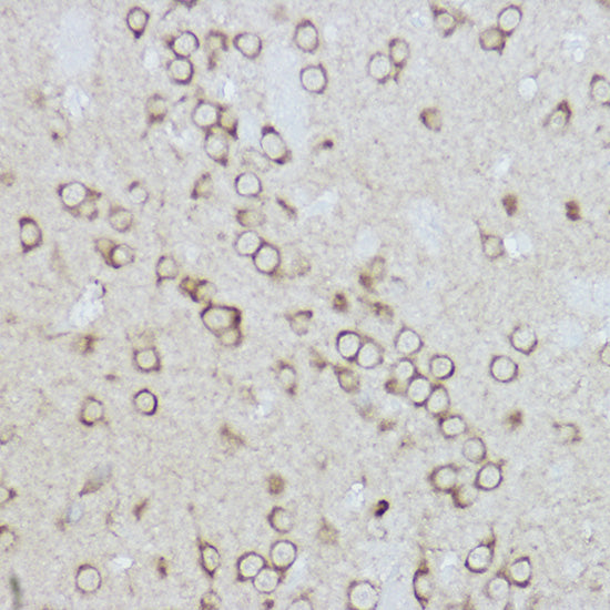BiP/GRP78 Rabbit pAb