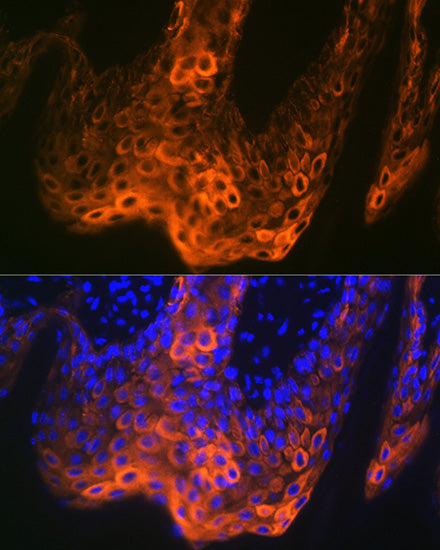 Cytokeratin 5 Rabbit mAb
