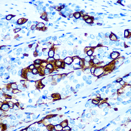 Cytokeratin 5 Rabbit mAb