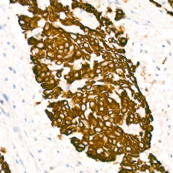 Cytokeratin 5 Rabbit mAb