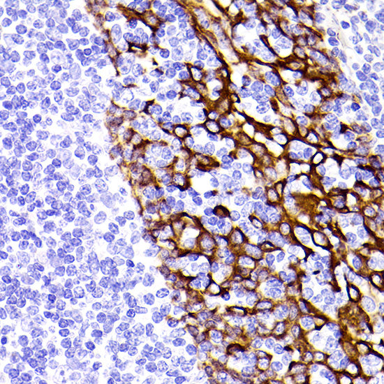 Cytokeratin 5 Rabbit mAb