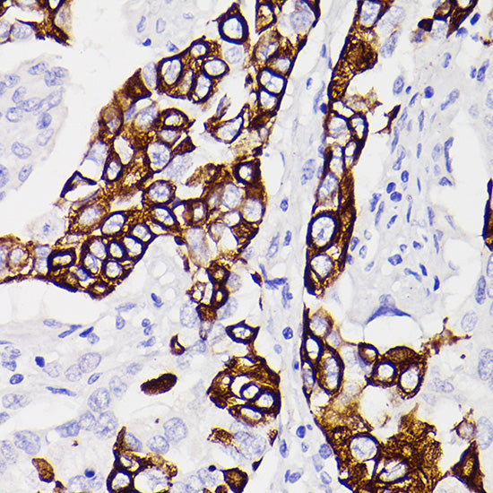 Cytokeratin 5 Rabbit mAb