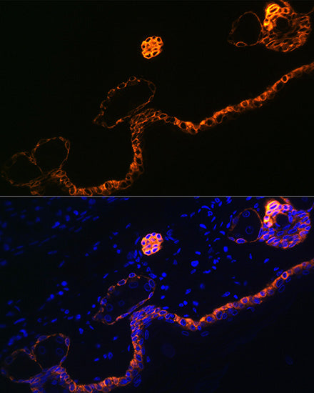 Cytokeratin 5 Rabbit mAb