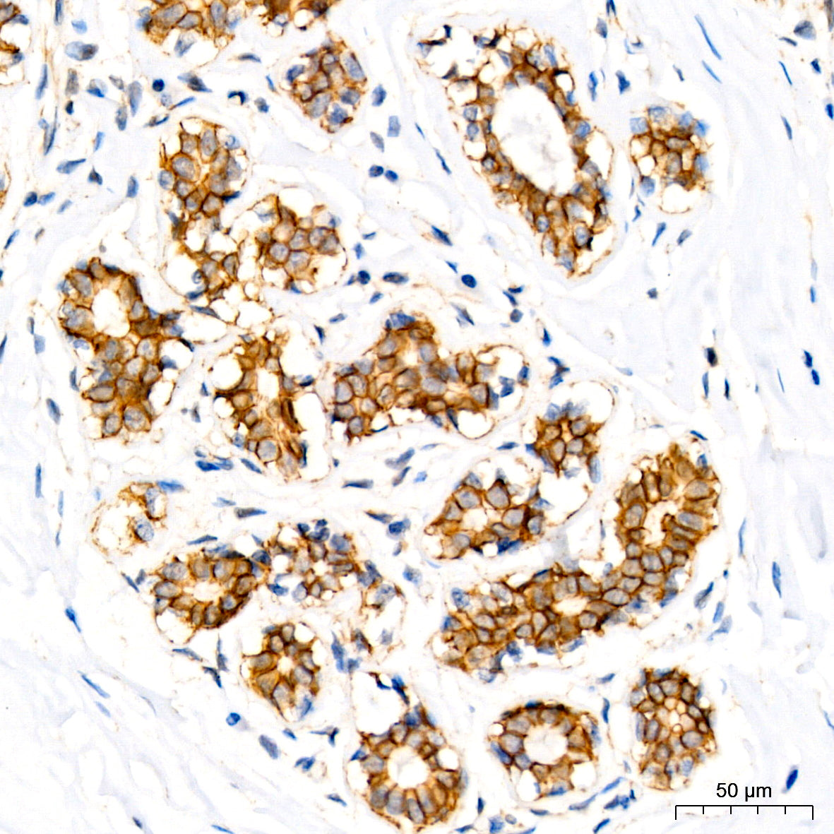 δ-Catenin/p120 Catenin Rabbit mAb