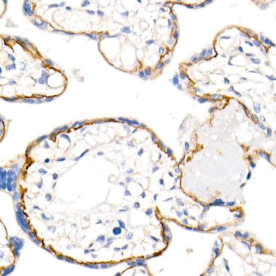 δ-Catenin/p120 Catenin Rabbit mAb