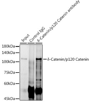 δ-Catenin/p120 Catenin Rabbit mAb