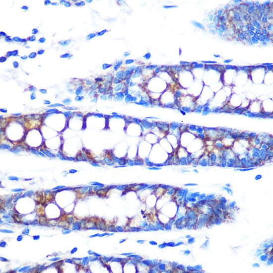 BMP4 Rabbit mAb