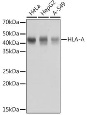 HLA-A Rabbit mAb
