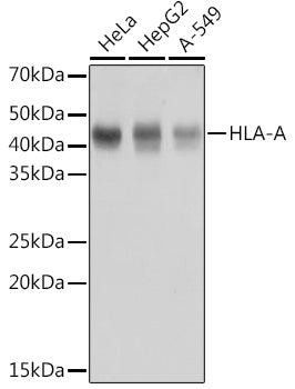 HLA-A Rabbit mAb