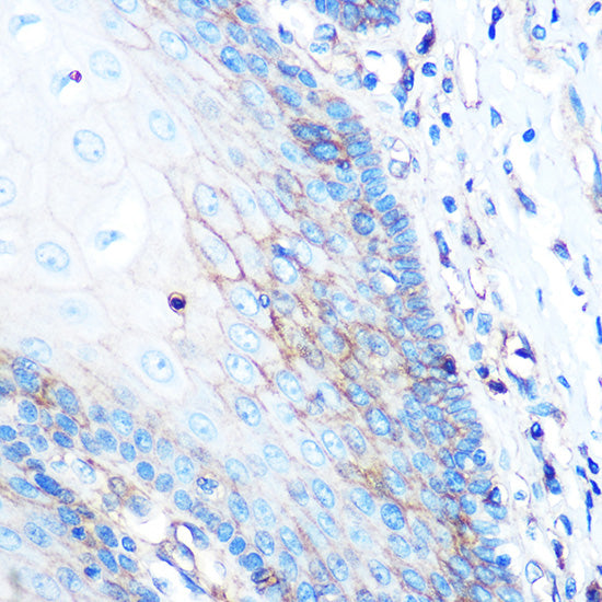 HLA-A Rabbit mAb