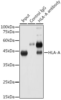 HLA-A Rabbit mAb
