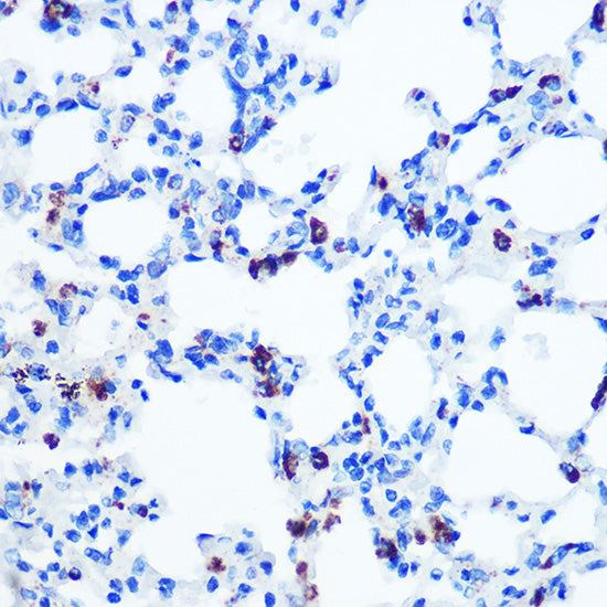 GM130 Rabbit mAb