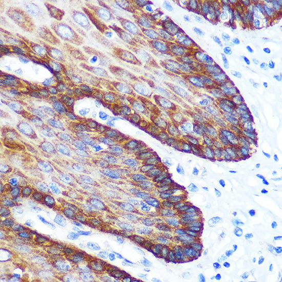 GM130 Rabbit mAb