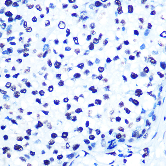 Histone H2AX Rabbit mAb