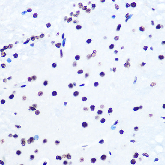 Histone H2AX Rabbit mAb