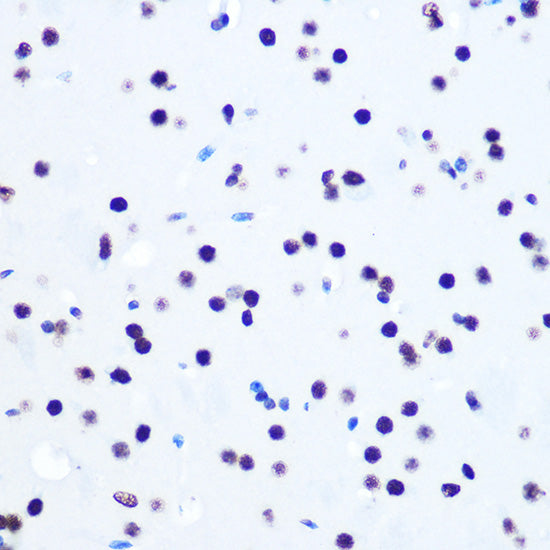 Histone H2AX Rabbit mAb