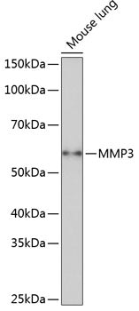 MMP3 Rabbit mAb