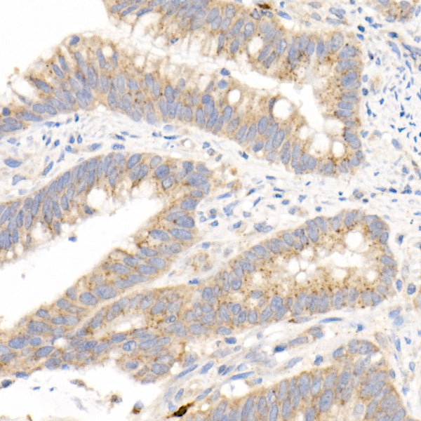 MMP3 Rabbit mAb