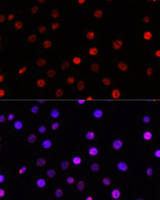 TCF4 Rabbit pAb