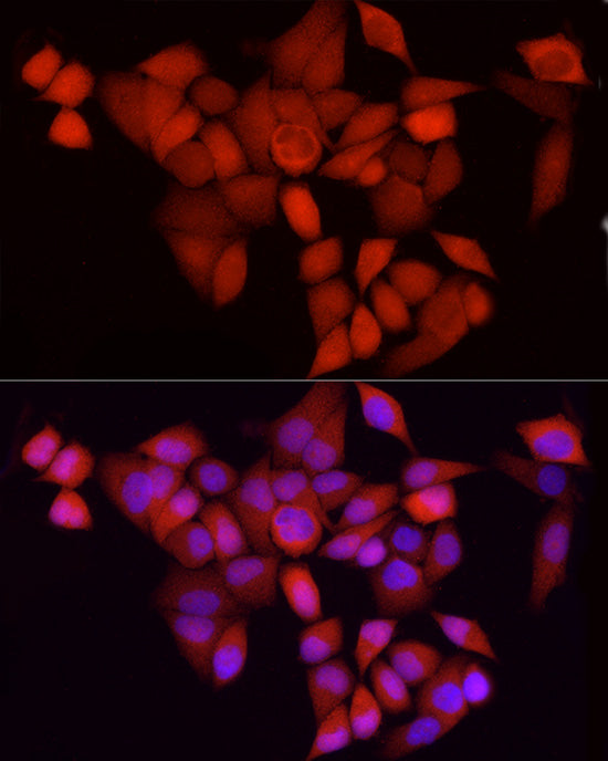 CDK1 Rabbit mAb