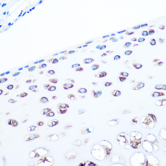 ALDOA Rabbit mAb