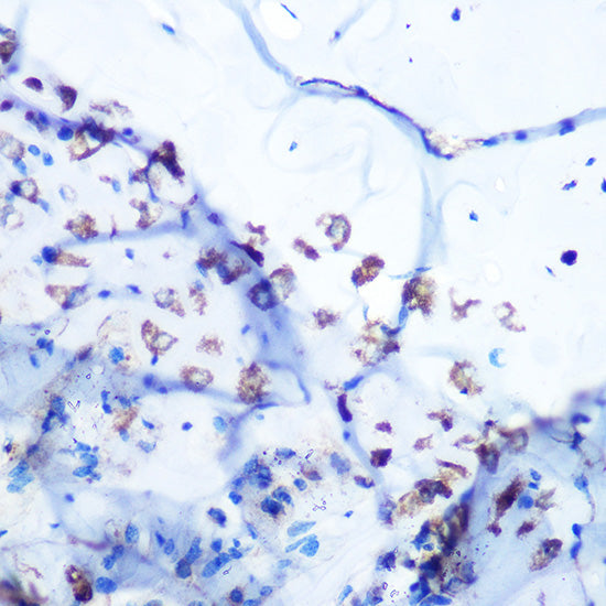 ALDOA Rabbit mAb