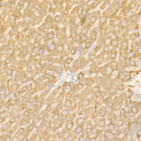 Ferritin Heavy Chain Rabbit pAb