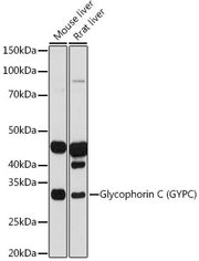 Glycophorin C (GYPC) Rabbit mAb