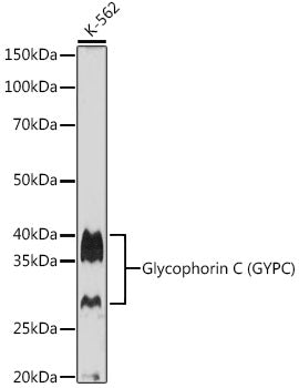 Glycophorin C (GYPC) Rabbit mAb