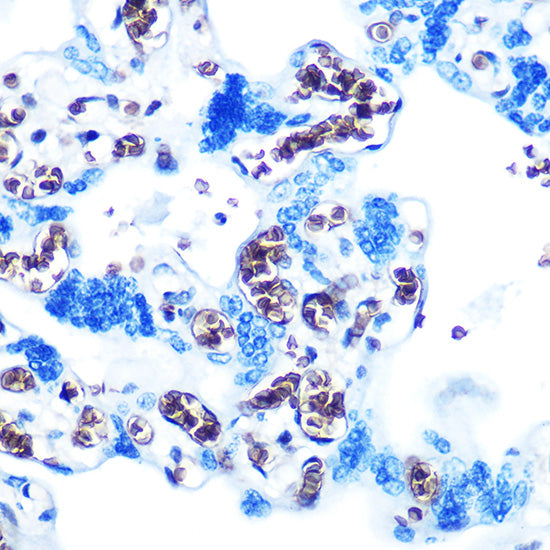 Glycophorin C (GYPC) Rabbit mAb