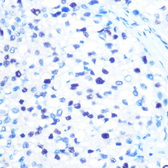 MCM3 Rabbit mAb