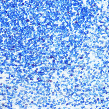 MCM3 Rabbit mAb
