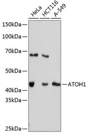 ATOH1 Rabbit mAb