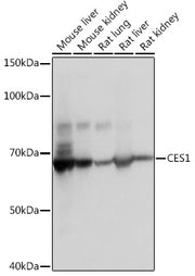 CES1 Rabbit mAb