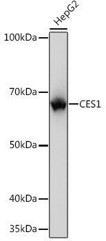 CES1 Rabbit mAb