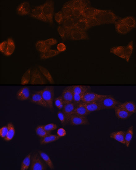 CES1 Rabbit mAb