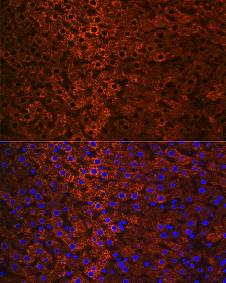 CES1 Rabbit mAb