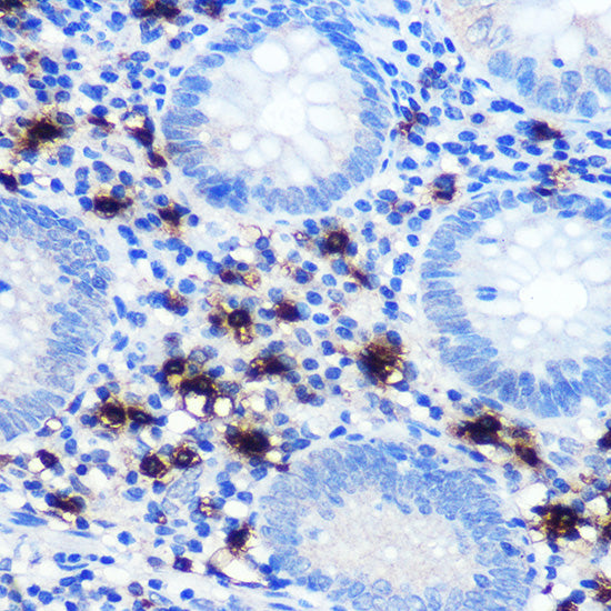 Mast Cell Chymase (CMA1) Rabbit mAb
