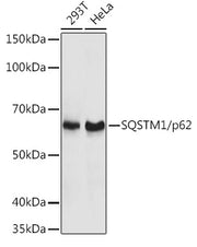 SQSTM1/p62 Rabbit pAb