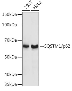 SQSTM1/p62 Rabbit pAb