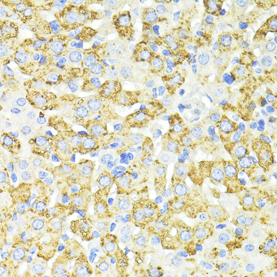 SQSTM1/p62 Rabbit pAb